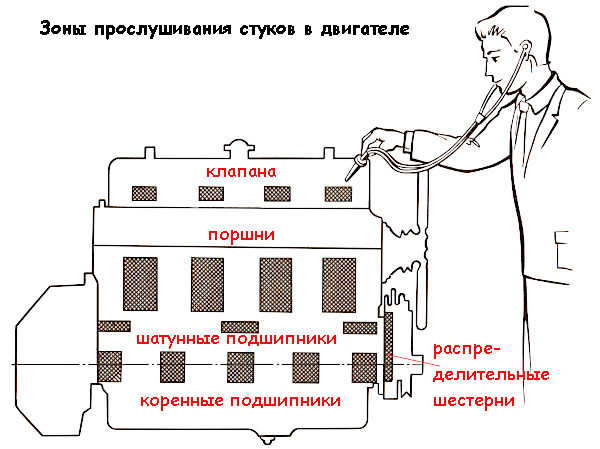 зоны прослушивания стуков в двигателе